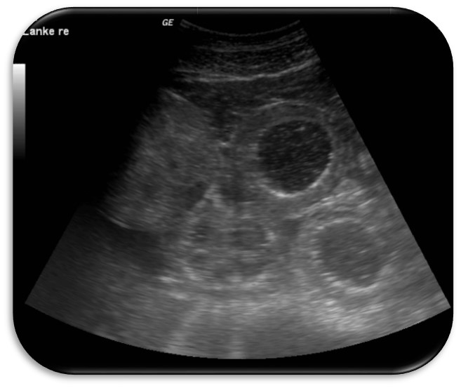 Ultraschalluntersuchung des Abdomen